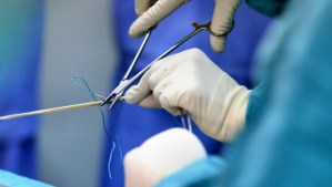 Anterior_cruciate_ligament_reconstruction_ACL_reconstruction-620x350